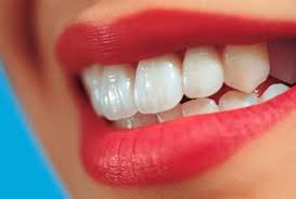 لأسنان بيضاء جذابة