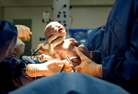 في حالة طبية طارئة ولادة قيصرية ناجحة للطبيبة ندى إدريس لأبناء إعلامي بالشرقية